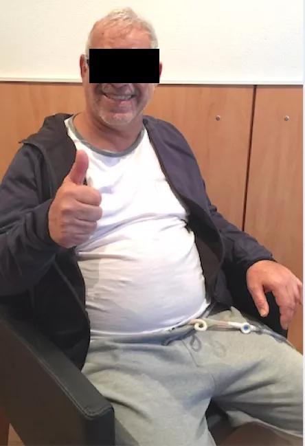 5毫升就可能致命的“脑干出血”到底有多可怕？能治得好吗？能手术吗？